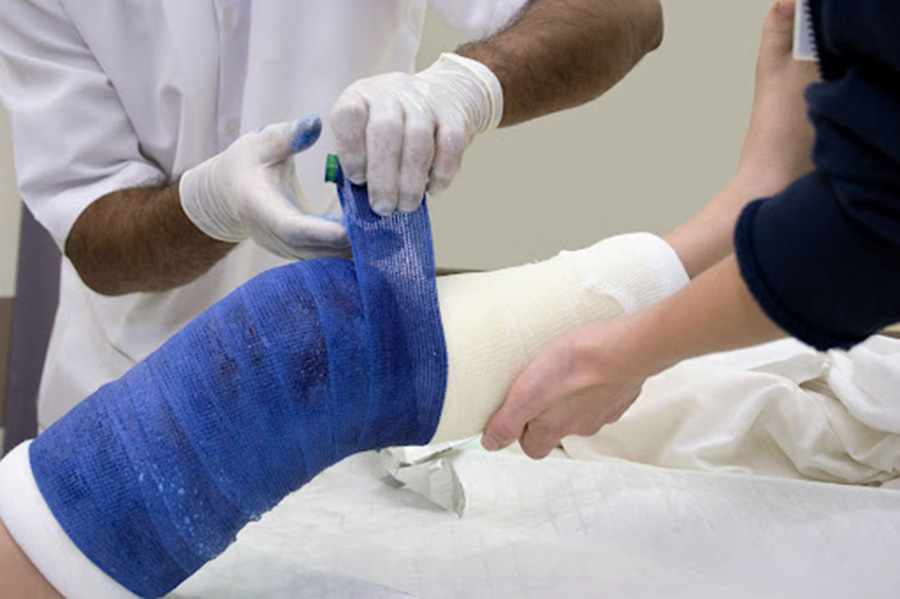 Persons leg being wrapped in nonwoven cast